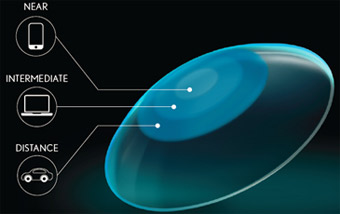 ultra contact lens for presbyopia